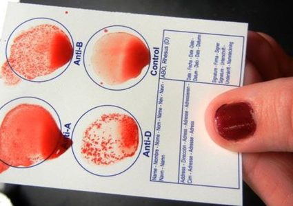 دراسة: فصيلة الدم "AB" تزيد خطر الاصابة بأمراض السرطان