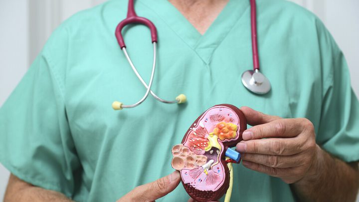 ظهور هذه العلامات.. قد تعني الإصابة بسرطان الكلى