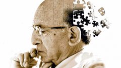 علماء روس يبتكرون عقارا يُبطئ تطور مرض ألزهايمر