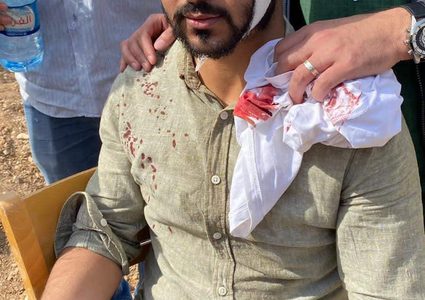 إصابة مواطن في اعتداء للمستوطنين شمال شرق الخليل