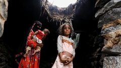 الأمم المتحدة: حصيلة ضحايا أزمة اليمن ستسجل 377 ألفا لنهاية العام