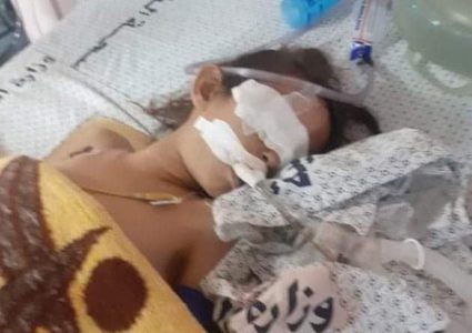 وفاة طفلة من غزة بسبب سمكة الأرنب السامة