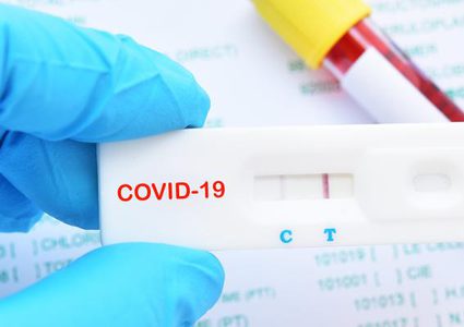 وفاتان و412 إصابة جديدة بـ"كورونا" خلال الـ24 ساعة الماضية