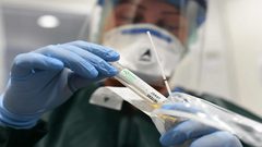 الصحة العالمية: "أوميكرون" ينتشر بسرع ويجعل اللقاحات أقل فاعلية