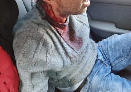 إصابة شاب بقنبلة غاز والعشرات بالاختناق في برقة شمال نابلس