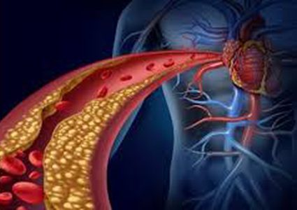 3 وصفات طبيعية لتخفيض الكوليسترول