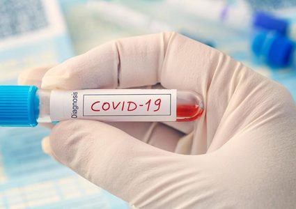 الصحة:3 وفيات و295 إصابة جديدة بـ"كورونا" خلال الـ24 ساعة الأخيرة