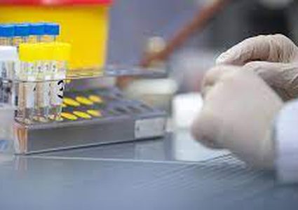 5 وفيات و156 إصابة جديدة بكورونا و235 حالة تعافٍ