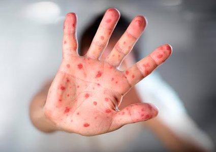 "الزراعة": تطعيم 200 ألف رأس من الأغنام والأبقار لمنع انتشار الحمى القلاعية