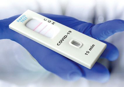 شداد عبد الحق: الصحة تسمح بتداول الفحص الذاتي السريع لفايروس كورونا