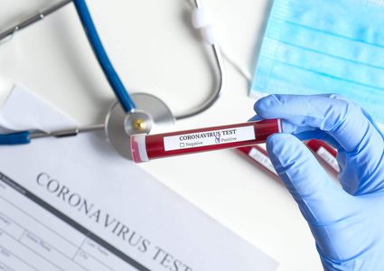 الصحة:11 وفاة و8657 إصابة جديدة بـ"كورونا"