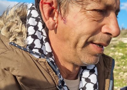 إصابة مواطن في اعتداء للمستوطنين قرب نابلس