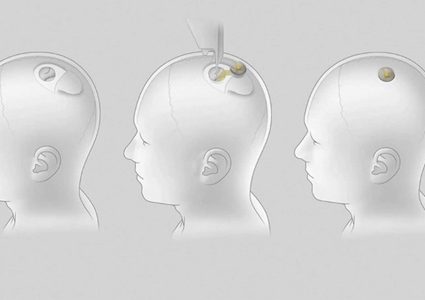 رقائق ماسك لأدمغة البشر.. أول "فاجعة" خلال التجارب