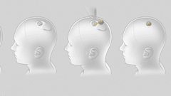 رقائق ماسك لأدمغة البشر.. أول "فاجعة" خلال التجارب