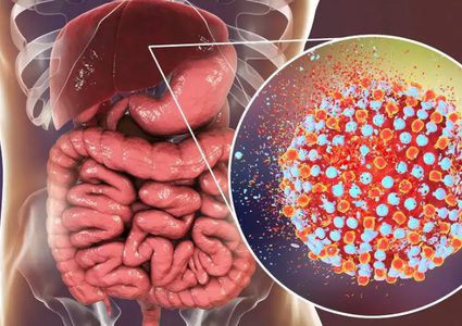 كيف تسبب إصابة الكبد المزمنة فقدان العظام؟