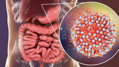 كيف تسبب إصابة الكبد المزمنة فقدان العظام؟