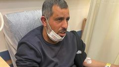 اعتقال سائق حافلة من رهط بعد تعرضه لاعتداء من متطرفين يهود