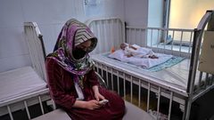 أفغانستان: وفاة 323 طفلا بسبب سوء التغذية منذ بداية العام