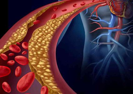 تعرف على الفرق بين الكوليسترول الجيد والضار