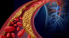 تعرف على الفرق بين الكوليسترول الجيد والضار