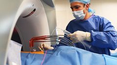 سرطان العظام.. "جرس إنذار" يتجاهله معظم الناس