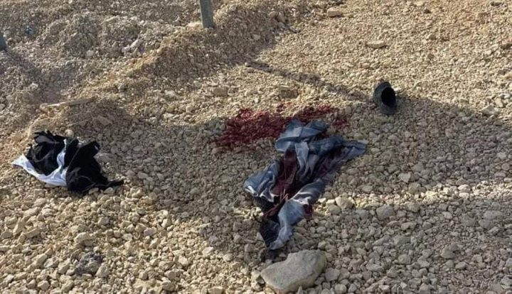 الاحتلال يصيب شابا بالرصاص ويعتقله عند مدخل البيرة الشمالي