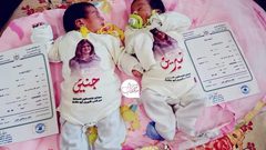 مواطن من غزة يطلق على توأمه "شيرين" و"جنين"