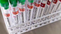 الصحة العالمية: من غير المحتمل أن يتحول جدري القردة إلى جائحة