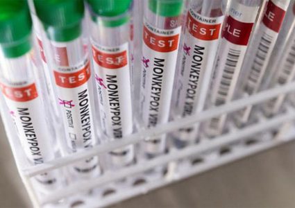 الصحة العالمية: من غير المحتمل أن يتحول جدري القردة إلى جائحة