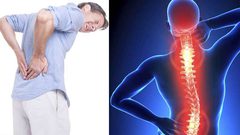 دواء واعد يعالج حالات "الديسك" الصعبة في العمود الفقري