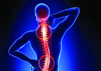 دواء واعد يعالج حالات "الديسك" الصعبة في العمود الفقري