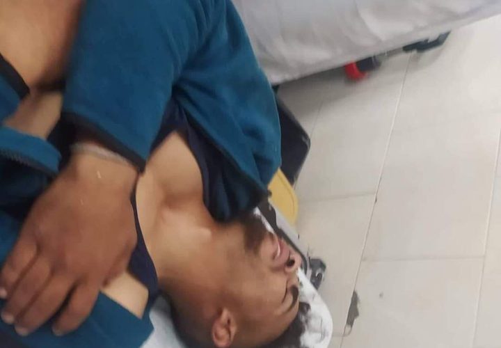 إصابة 3 صيادين برصاص معدني مغلف بالمطاط؛ جراء اعتداء زوارق الاحتلال عليهم في بحر الشمال وتدمير محرك قارب الصياد حسام محمد بكر