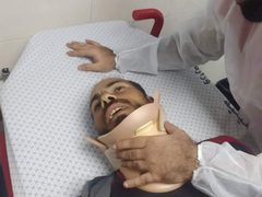 إصابة 3 صيادين برصاص معدني مغلف بالمطاط؛ جراء اعتداء زوارق الاحتلال عليهم في بحر الشمال وتدمير محرك قارب الصياد حسام محمد بكر
