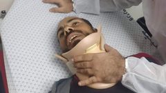 إصابة 3 صيادين برصاص معدني مغلف بالمطاط؛ جراء اعتداء زوارق الاحتلال عليهم في بحر الشمال وتدمير محرك قارب الصياد حسام محمد بكر