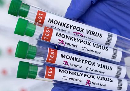 الصحة العالمية:أكثر من 5 آلاف إصابة بجدري القردة في العالم