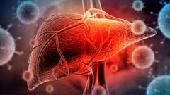 علامات خطيرة تشير إلى تلف الكبد