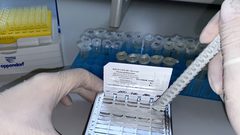 جمهورية ياكوتيا الروسية تنفي الشائعات حول تسجيلها إصابات بجدري القردة في أراضيها