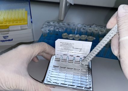 جمهورية ياكوتيا الروسية تنفي الشائعات حول تسجيلها إصابات بجدري القردة في أراضيها