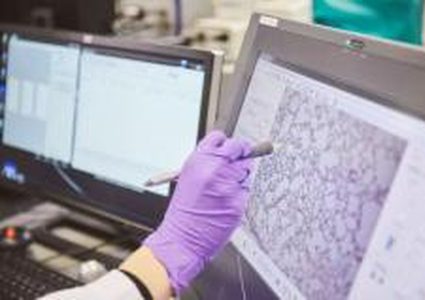 دراسة: التوجه نحو منتجات التبغ المسخن كخيار للتخلص من الحرق