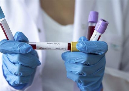 4 وفيات و593 إصابة جديدة بفيروس "كورونا" و3597 حالة تعاف