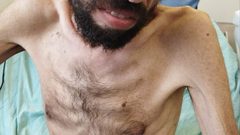 صور مؤلمة  تظهر الوضع الصحي الخطير الذي وصل له الأسير المضرب عن الطعام خليل عواودة