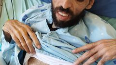 الأسير خليل عواودة يواجه وضعا صحيا خطيرا نتيجة الإضراب عن الطعام