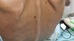 صور مؤلمة  تظهر الوضع الصحي الخطير الذي وصل له الأسير المضرب عن الطعام خليل عواودة