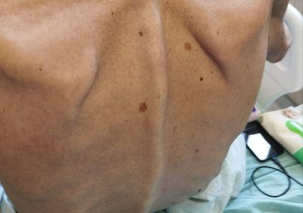 الأسير خليل عواودة يواجه وضعا صحيا خطيرا نتيجة الإضراب عن الطعام