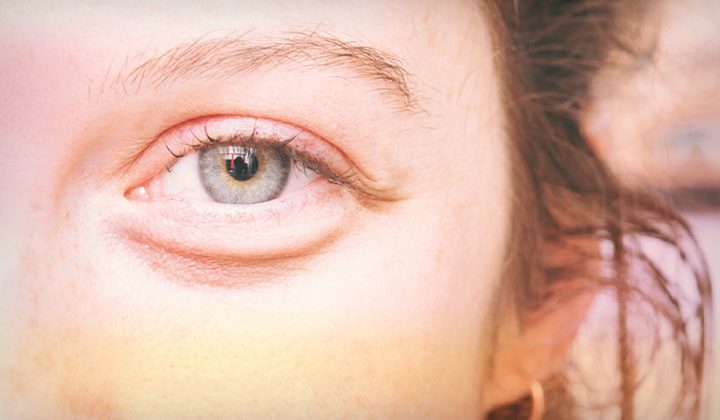 باحثان يحصلون على جائزة فيجن ٢٠٢٢