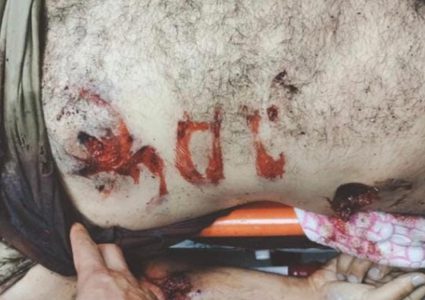 عاطف أبو الرب:جندي احتلالي خط شعارات عنصرية على بطن شهيد في المنزل المحاصر بجنين