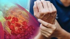 ما هي الأسباب الرئيسية لارتفاع الكوليسترول؟