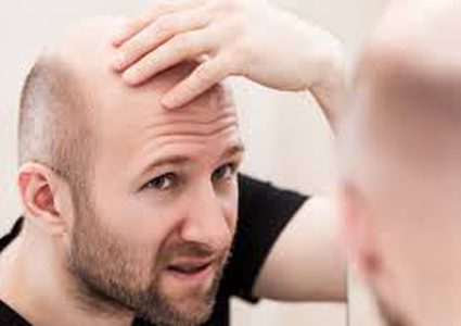 مشروبات شائعة تؤدي إلى الصلع