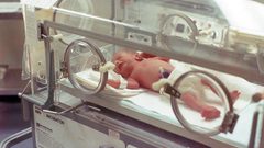 تقرير:وفيات الأطفال دون السن الخامسة في العالم لا تزال عند مستويات "مقلقة"