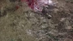 إصابة مواطن عقب انفجار قنبلة من مخلفات الاحتلال جنوب الخليل